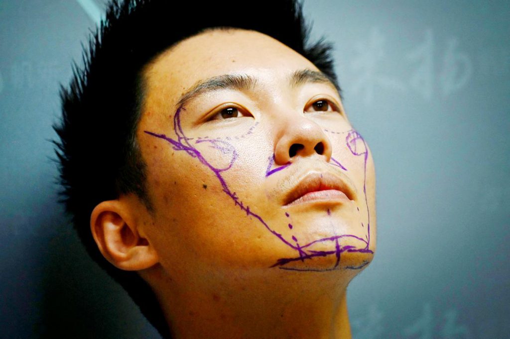 فواید و عوارض زاویه سازی فک چیست؟