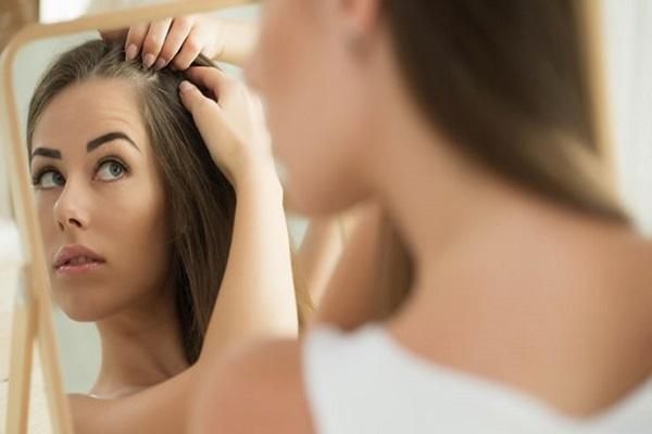 نحوه پنهان کردن کم پشتی جلوی سر زنان و طاسی سر زنان، علل شایع ریزش مو جلوی سر زنان 