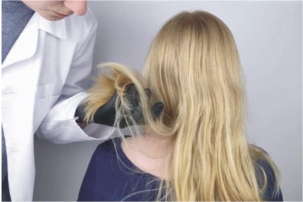 آناتومی مو چیست؟ نحوه رشد مو، ریزش مو و راههای مراقبت از مو