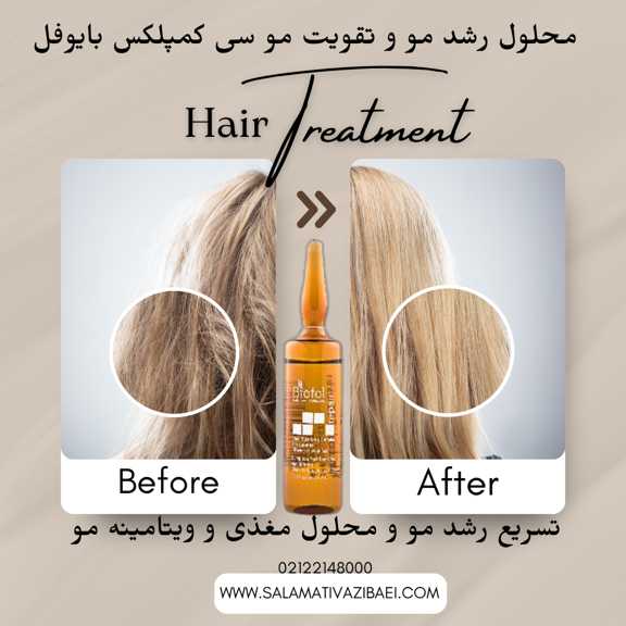 محلول رشد مو