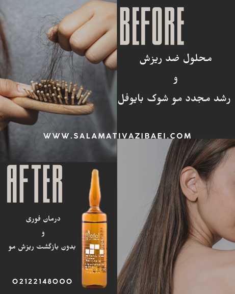 سرم ضد ریزش مو