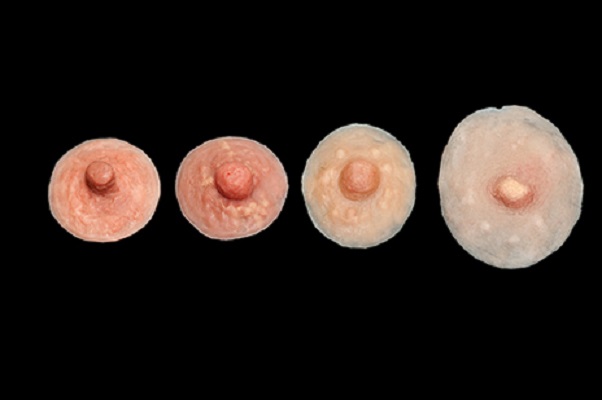 علل، پیشگیری و درمان پف نوک سینه چیست؟